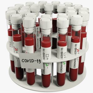 COVID-19 Antibody Rapid Tests