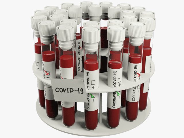 COVID-19 Antibody Rapid Tests