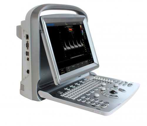 Chison ECO 5 Ultrasound Imaging System