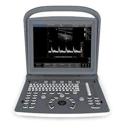 Chison Eco 2 Portable Ultrasound