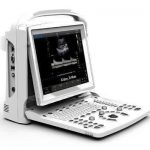 Chison ECO 3 Expert Ultrasound Machine